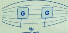 SPORT ELEC NEW GENERATION - Exemples : cuisse gauche - 2