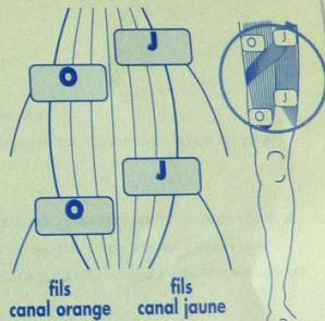 SPORT ELEC NEW GENERATION - Exemples : cuisse gauche - 1