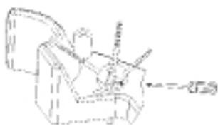 KOENIG WR515 - Remplacement de larosse latérale - 2