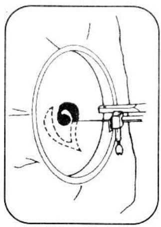 TRIOMPH ETF 947 - AIGUILLE JUMELLE (Option) - 3