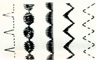 MERRITT 157 - Exécution de points d'ornament (Modèle 158 seulement) - 1