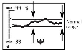 SOEHNLE BODY BALANCE COMFORT F5 - Trend curve - 1