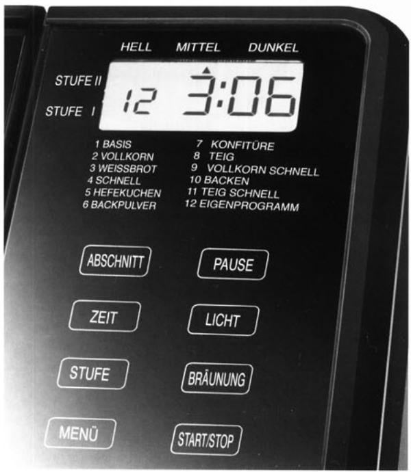 UNOLD BACKMEISTER - STUFE - 1