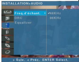 PHOCUS DVHD 160 - DRC (Dynamic Range Control) - 1