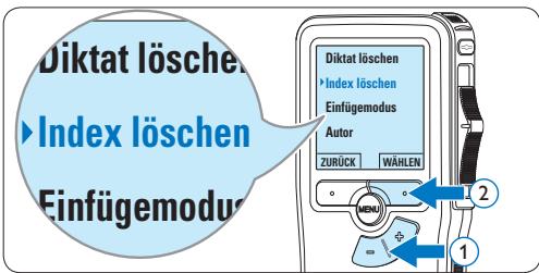 PHILIPS LFH-9172 - Löschen einer Indexmarkierung - 2