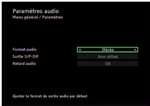 PHILIPS DSR 2020 - Sortie video analogue - 2