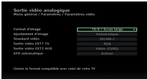 PHILIPS DSR 2020 - Sortie video analogue - 1