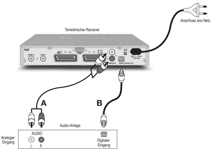 PHILIPS DTR 300 - Anschluss an eine HiFi/Audio-Anlage (Analog/Digital) - 1