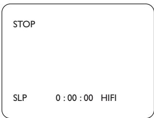 PHILIPS DVD750VR - Helpful Hint - 2