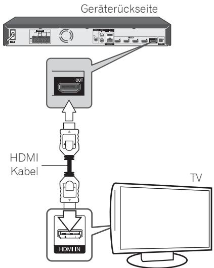 PIONEER MCS-737 - HDMI-Anschluss - 1