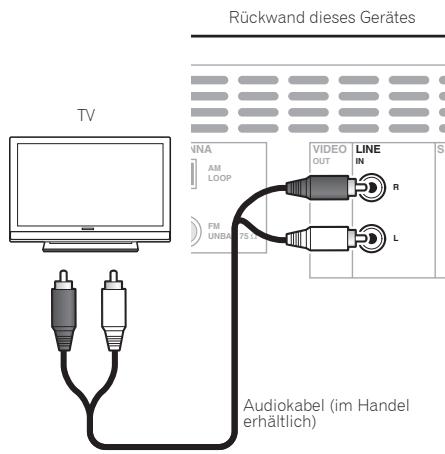 PIONEER X-CM31-J - Hinweis - 1