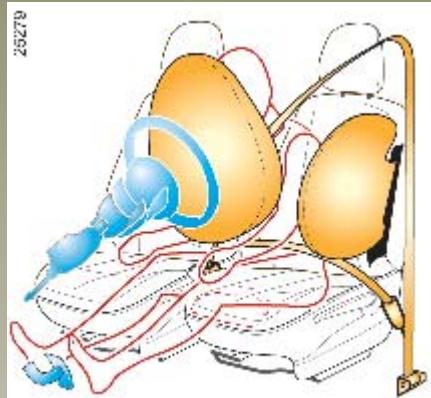 RENAULT CLIO 3 - DISPOSITIFS COMPLEMENTAIRS À LA CEINTURE AVANT (suite) - 1
