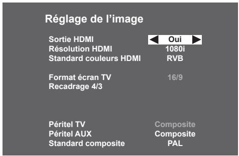 SAGEM DS86 HD - 6-2-1 Sorties en utilisation HD - 1