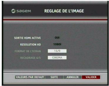 SAGEM DT85N HD - Réglage de l'image - 1