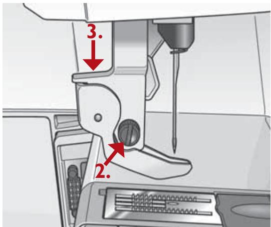 HUSQVARNA 400 COMPUTER - Removing the Embroidery Foot U - 1