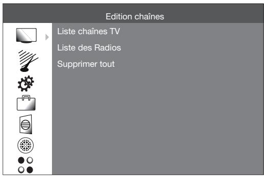 ESSENTIELB CONSENTIUM T2 - Menu ÉDITION CHÂINES - 1