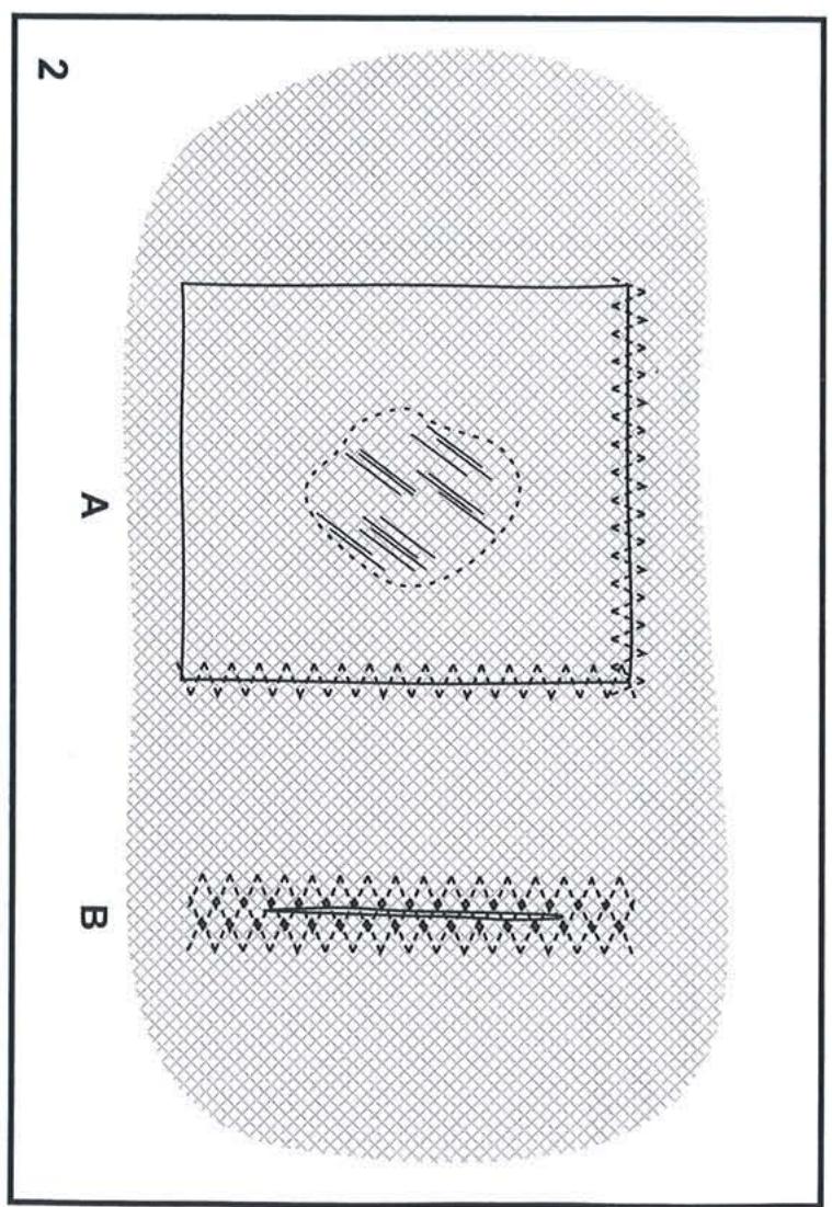 SINGER CELIA - Point zigzag multipoints - 3
