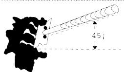 SAUTER ET 25 B - FOYERS Radiants et halogenes - 1
