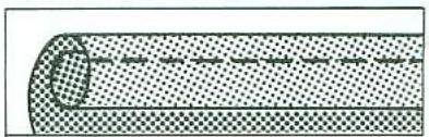 TOSHIBA 2444 - POSE DE FERMETURES ECLAIRS - 3