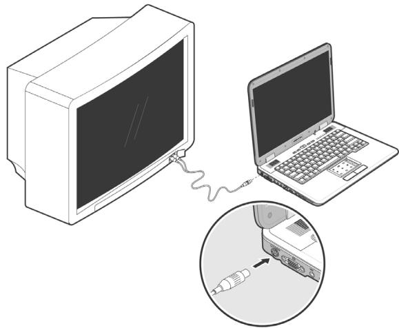 MEDION BDAWIM2100 - Branchement d'un téléviseur - 1
