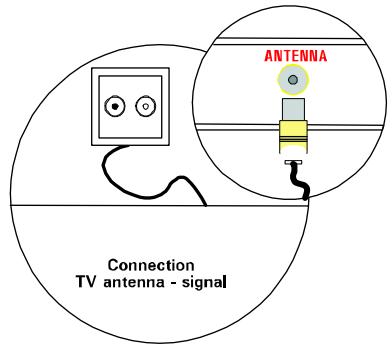 MEDION 42 PLASMA DISPLAY MD 41842 - Liitäntä ja päälekytkentä - 1