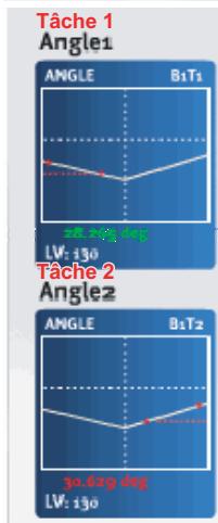 OMRON ZG - Mesure d'angle - siège de vehicule - 1