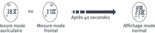 TIGEX THERMOMETRE PARLANT AURICULAIRE ET FRONTAL - Affichage des températures mesurées - 1