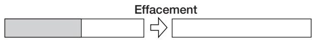 ZOOM MRS-1608 - Effacement d'une v-take - 1