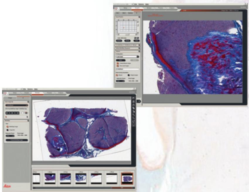 LEICA APPLICATION SUITE MULTISTEP - Acquisition automatique des images - 1