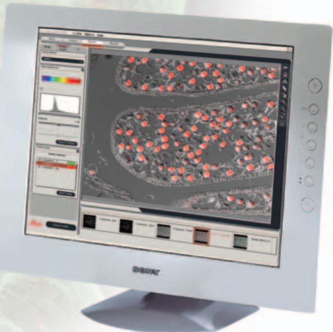 LEICA LAS IMAGE OVERLAY - Annotations - 1