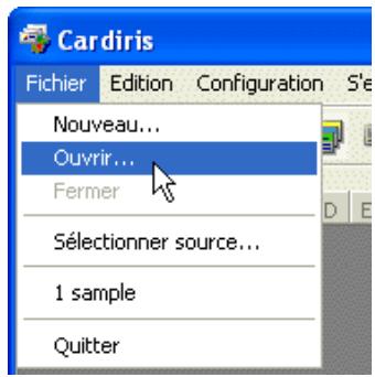 GENIUS BR600-CARDIRIS - Les MODES de visualisation - 1