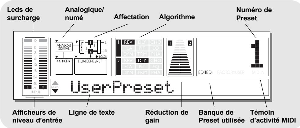 TC ELECTRONIC M-ONE ET - XLR-XLR - 4