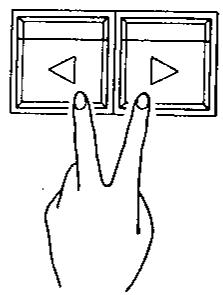 KAWAI X5000 - Procedure - 1