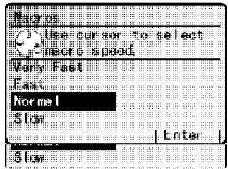 MURATEC MFX-2500 - Réglage de la vitesse des Macros - 1