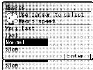 MURATEC MFX-2500 - Réglage de la vitesse des Macros - 1