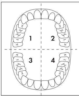 DENTALUX DAZ 2.4 A1 - Opmerking - 1