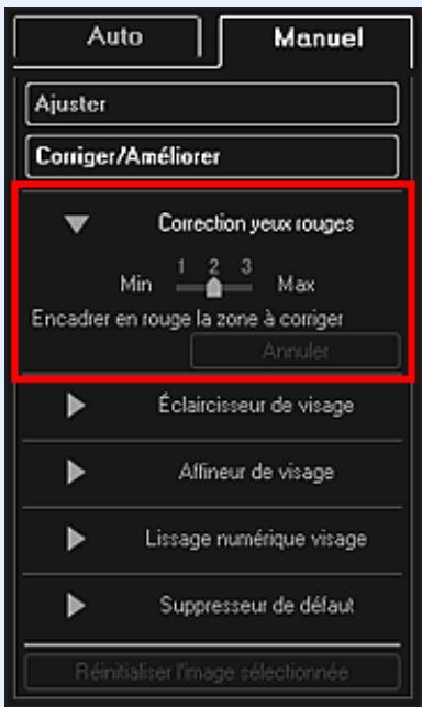 CANON PIXMA MG3150 - Correction manuelle - 1