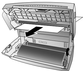 PHILIPS MAGIC 5 PRIMO - Eliminer le bourrage de papier - 3