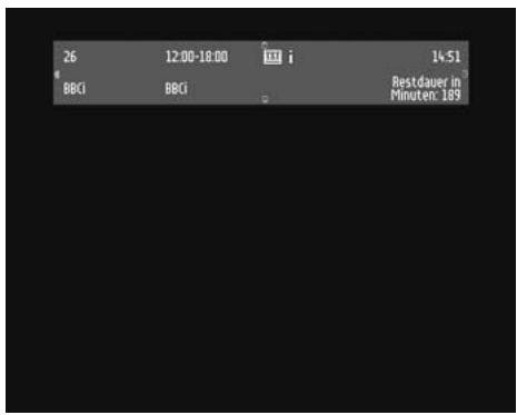 PHILIPS DTR300 - Lautstärkenregelung -1 +1 - 1
