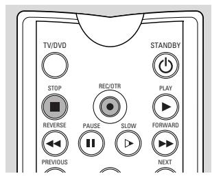 PHILIPS DVDR1000 - Opnemen - 3