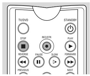 PHILIPS DVDR1000 - Opnemen - 3