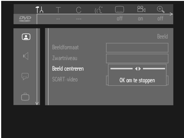 PHILIPS DVDR1000 - Beeldverschuiven - 1