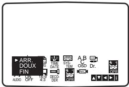 PHILIPS DVD755VR - (Optimum Picture Response) - 1