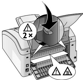 PHILIPS LASERFAX 5125 - Pièces de l'équipement chaudes - 1
