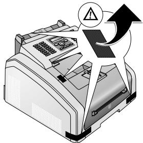 PHILIPS LASERFAX 5125 - Retirez le matériel d'emballage sur l'appareil. - 1