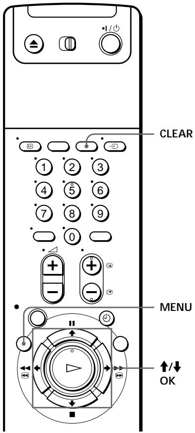 SONY SLV-SE70EG - Before you start... - 1