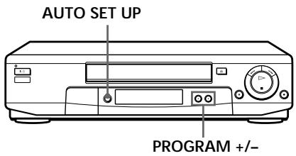 SONY SLV-SE70EG - Setting up the VCR with the Auto Set Up function - 1
