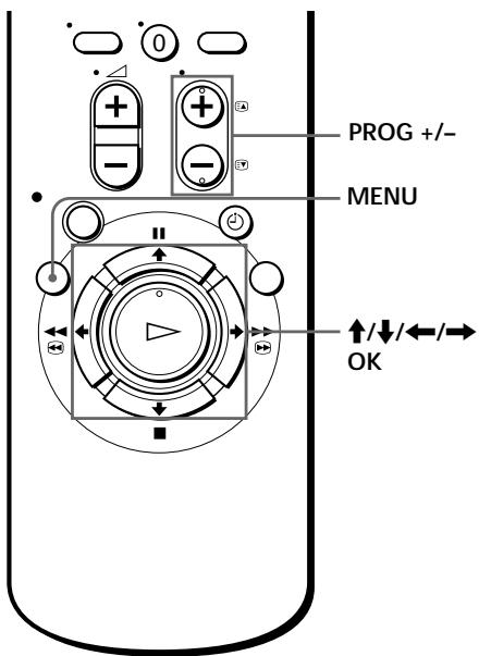 SONY SLV-SE70EG - Before you start... - 1