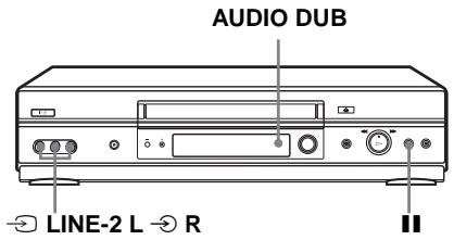 SONY SLV-SE740G - Before you start... - 1