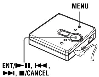 SONY MZ-NE410CK - Protección auditiva (AVLS) - 1